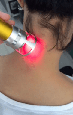 Laser terapia