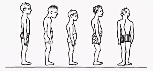 Postura urratzea