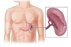 patologia spleen ezkerreko omoplatoaren azpian minaren kausa gisa